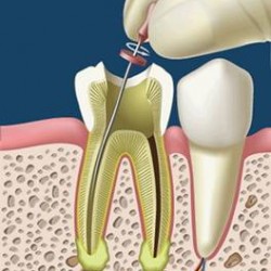 Servicios Odontológicos Express img-15