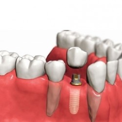 Servicios Odontológicos Express img-14