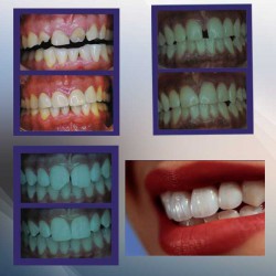 Nueva Imagen Dental img-0