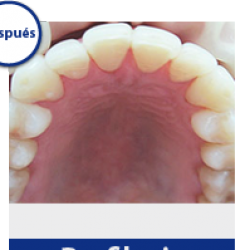 Nueva Imagen Dental img-1